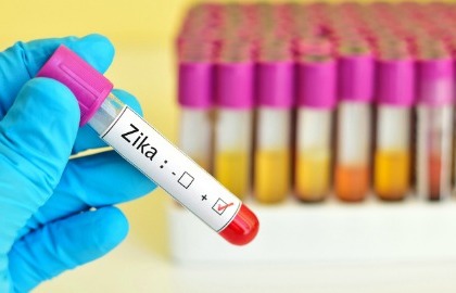 Il virus Zika permane anche sei mesi nel liquido seminale