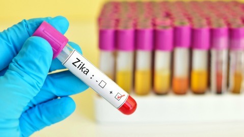 Il virus Zika permane anche sei mesi nel liquido seminale