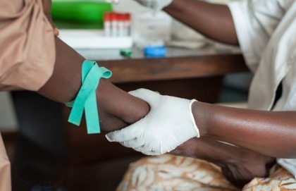 In Africa anche la lotta all’Aids subisce i danni di Ebola