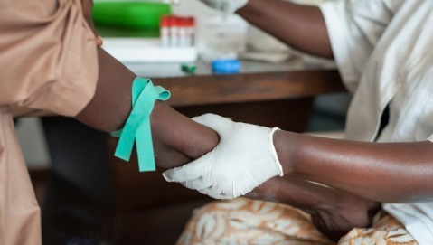 In Africa anche la lotta all’Aids subisce i danni di Ebola