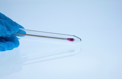 La ricerca del Dna è più efficace del Pap test?
