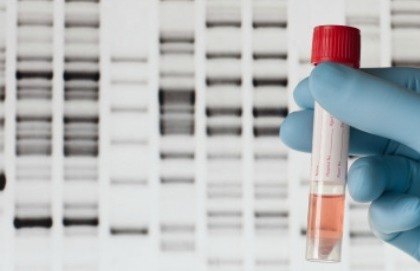Tracce di materiale genetico nel sangue per predire l’esito di un arresto cardiaco