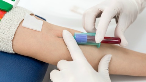 Analisi del sangue: quando occorre farle a digiuno?