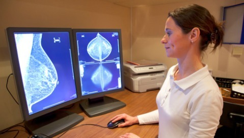 Risonanza magnetica (e non mammografia): quando si fa?