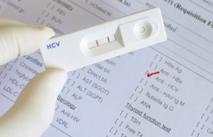 Epatite C: non è solo questione di fegato