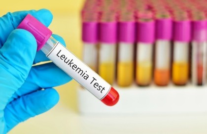 Leucemie fulminanti: guarire oggi si può