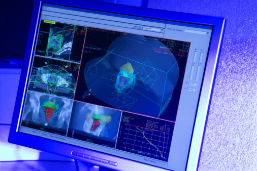 13 tappa: Savona-Cervere 121 Km
Le nanotecnologie, l&#x2019;arma in pi&#x00f9; contro i tumori